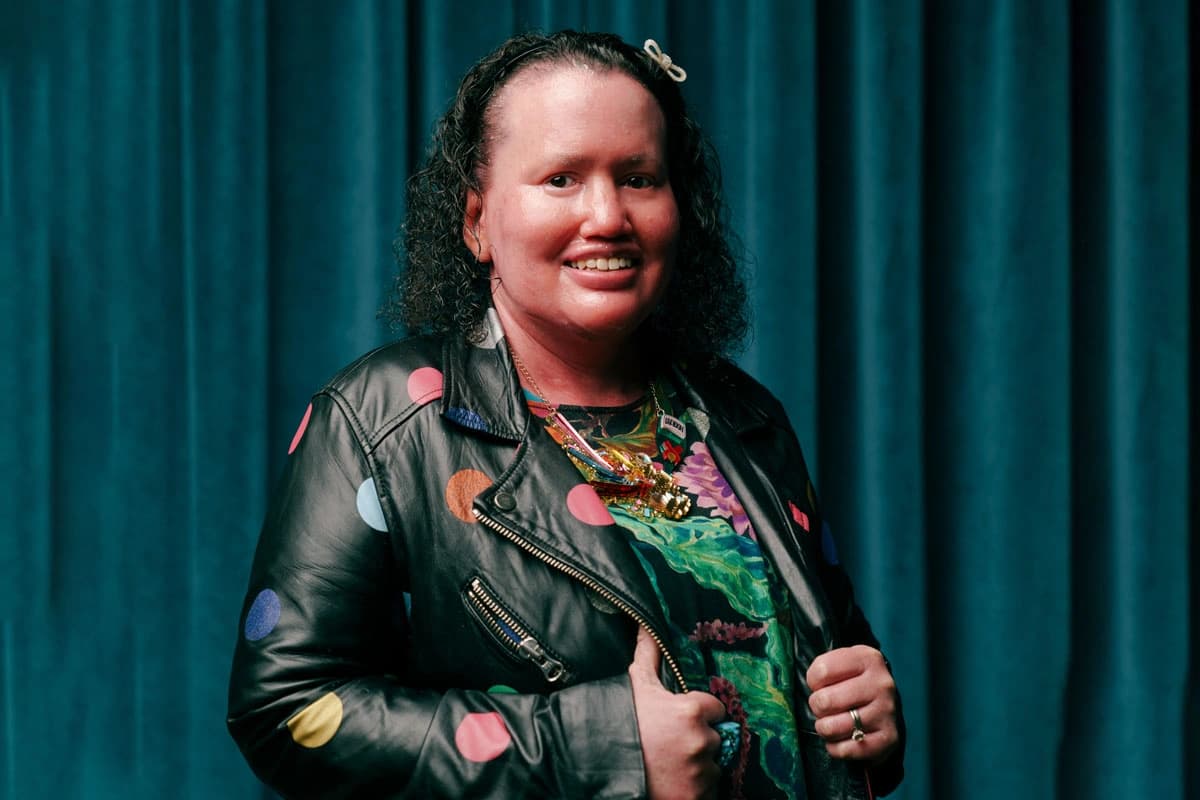 Carly Findlay OAM